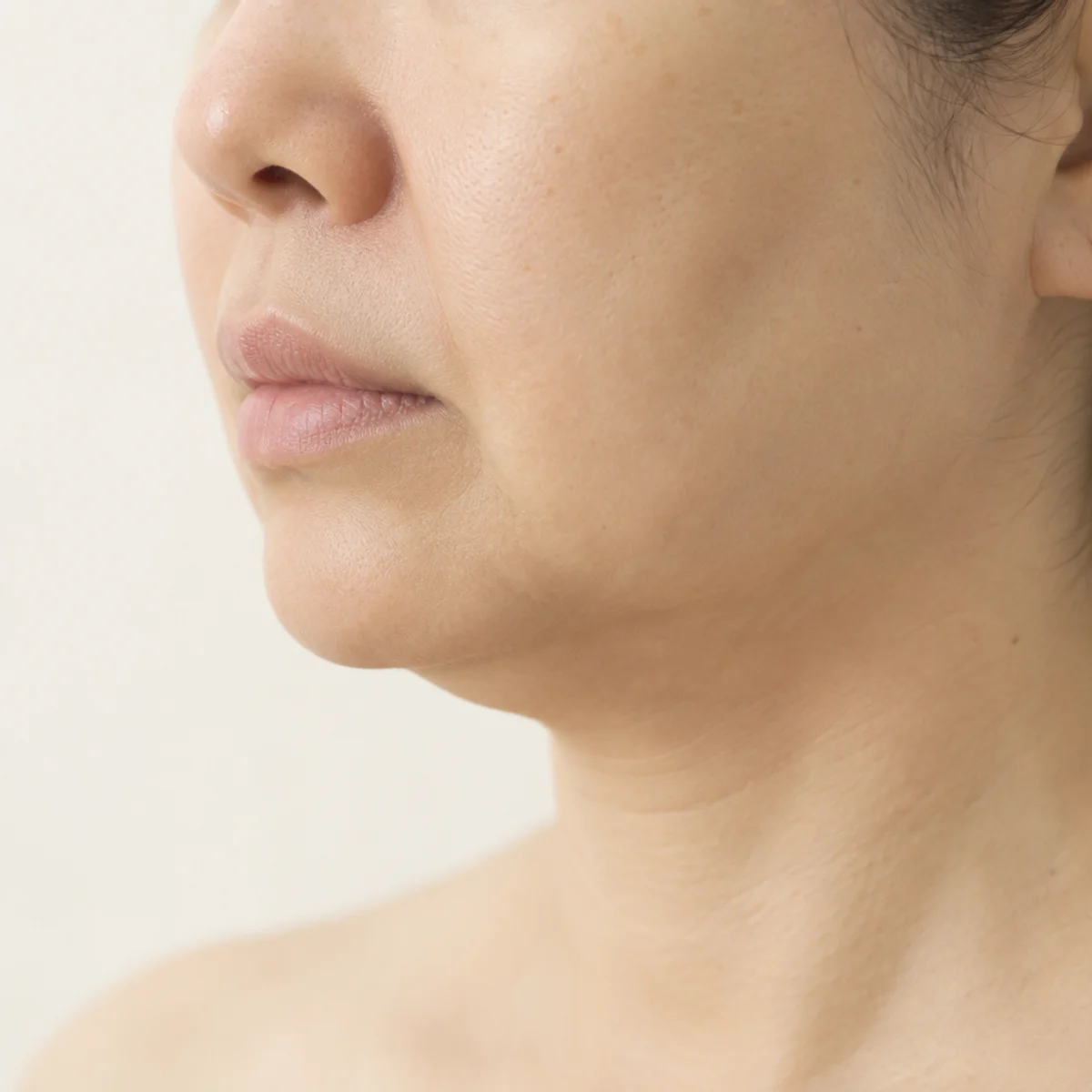 蘋果肌下移、下顎線模糊（示意）