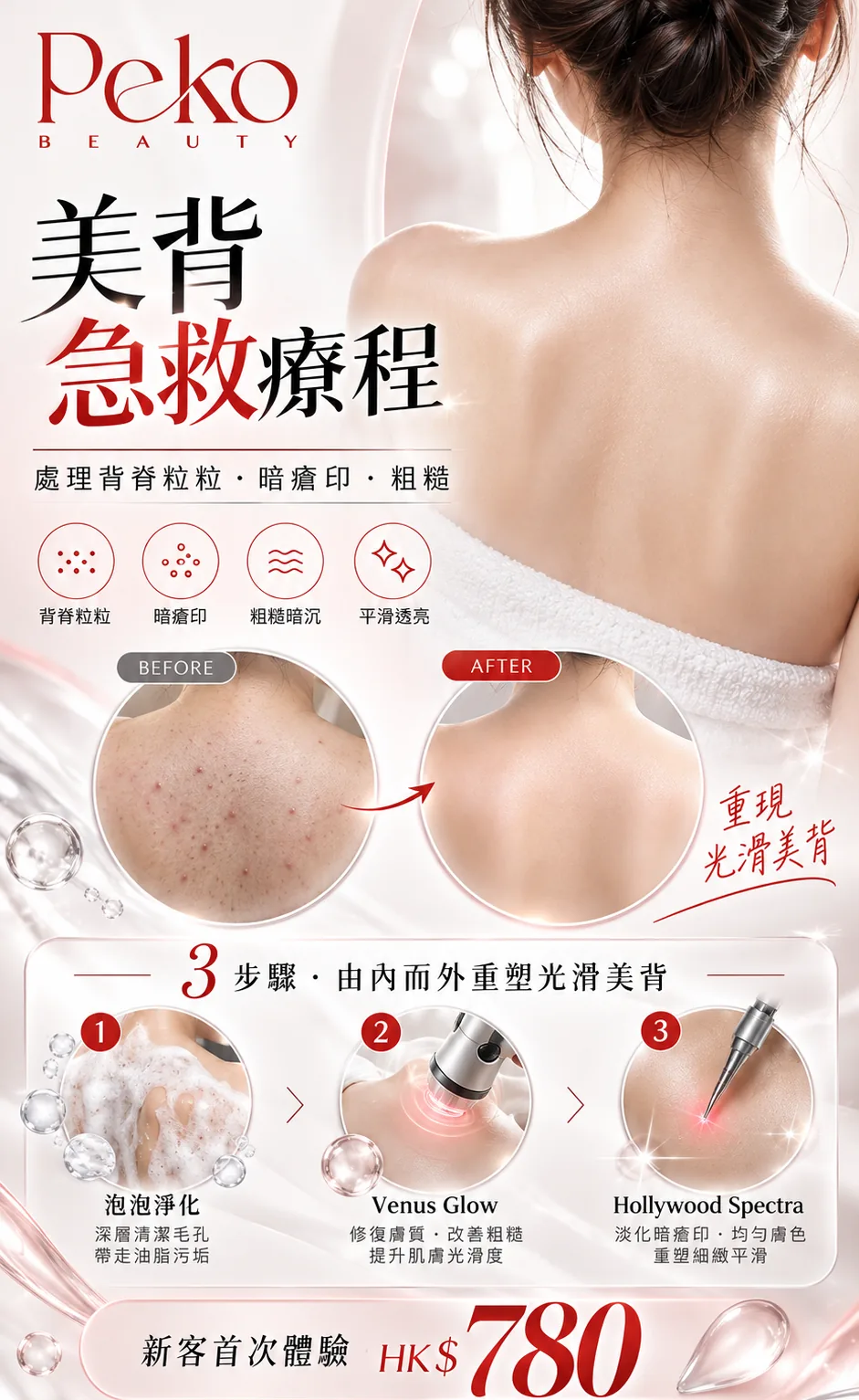 美背急救療程宣傳圖：處理背脊粒粒、暗瘡印、粗糙，新客首次體驗 HK$780