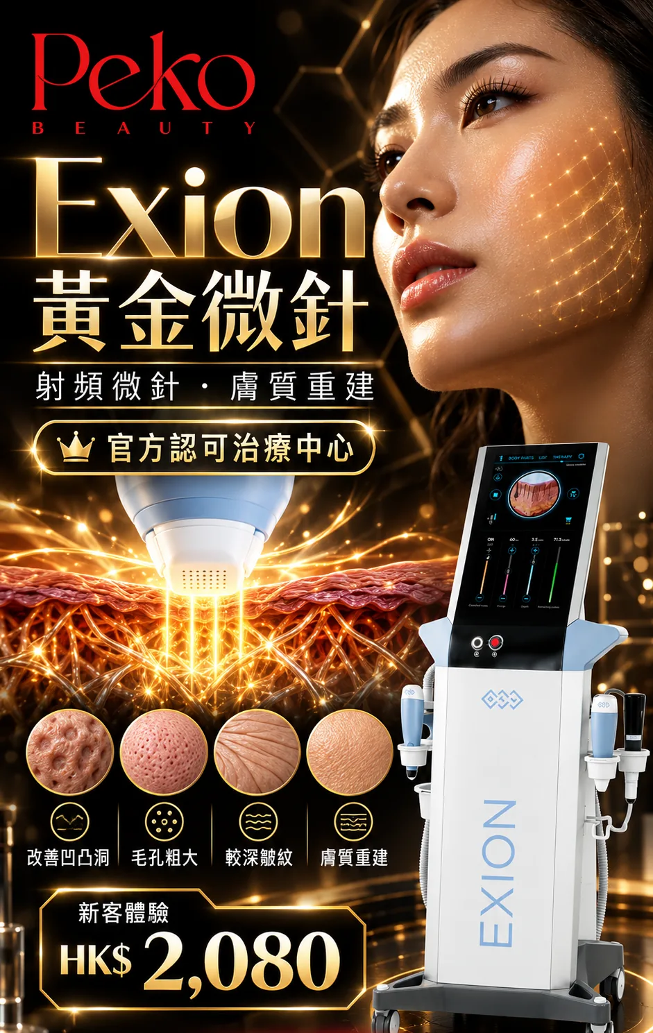 Exion 黃金微針宣傳圖：射頻微針、膚質重建，新客體驗 HK$2,080