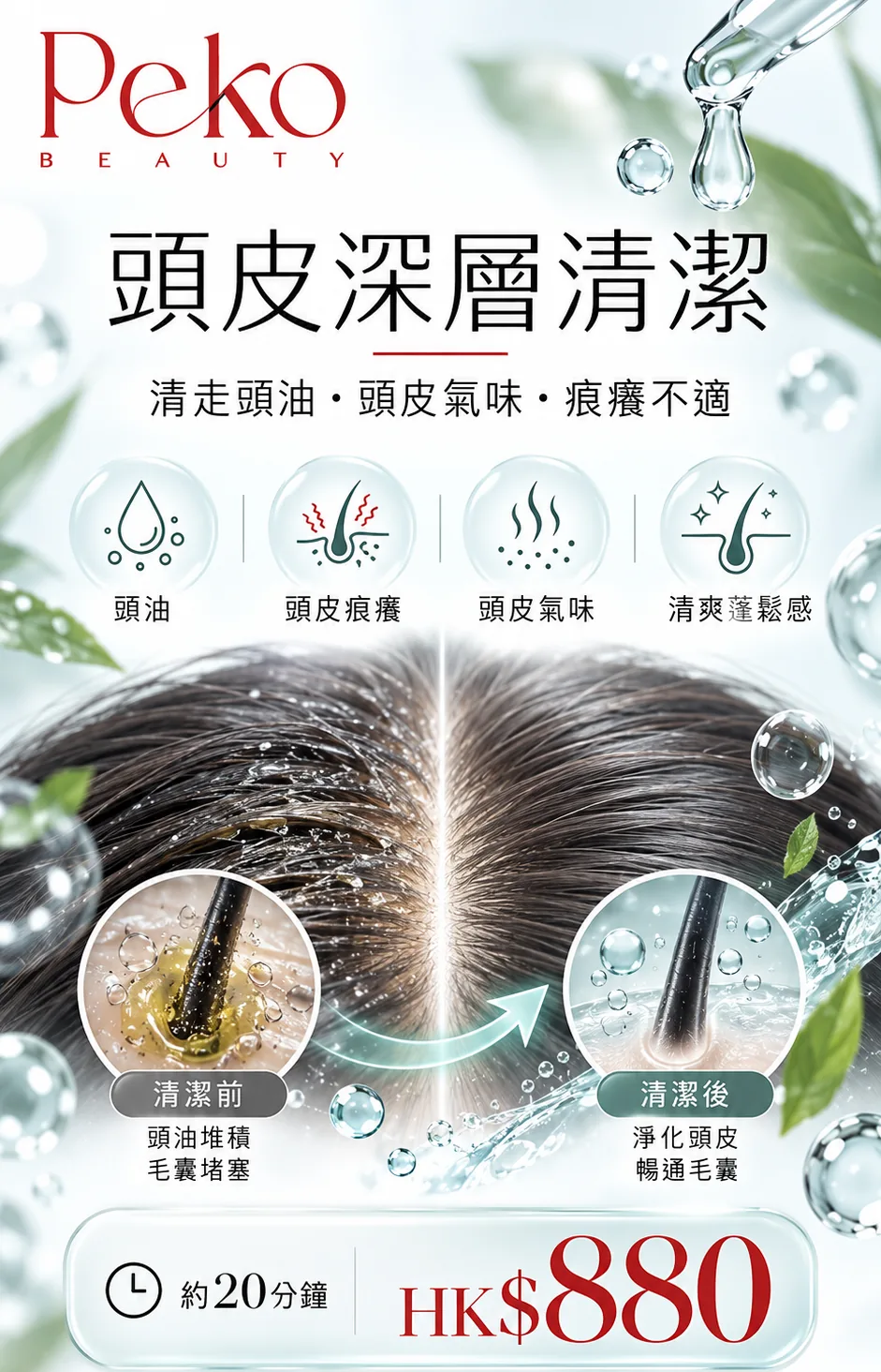 頭皮深層清潔宣傳圖：清走頭油、頭皮氣味、痕癢不適，約 20 分鐘，HK$880
