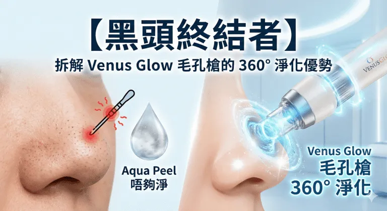 Aqua Peel 好唔好？同針清、Venus Glow 分別，去黑頭效果、會唔會越做越粗同價錢比較
