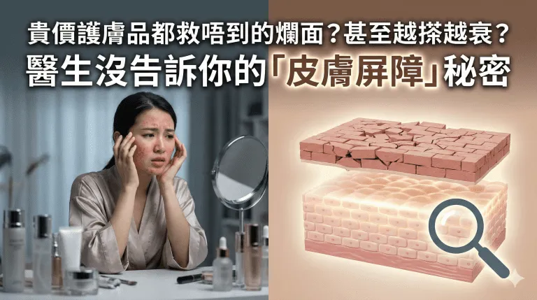 貴價護膚品都救唔到的爛面？甚至越搽越衰？合資格醫療專業人士沒告訴你的「皮膚屏障」秘密