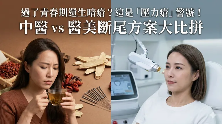 過了青春期還生暗瘡？這是「壓力瘡」警號！中醫 vs 醫美斷尾方案大比拼