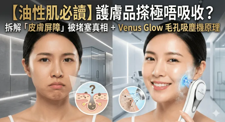 油性肌膚護膚品搽極唔吸收？拆解皮膚屏障被堵塞真相，Venus Glow 毛孔吸塵機點樣深層清走角栓同油污