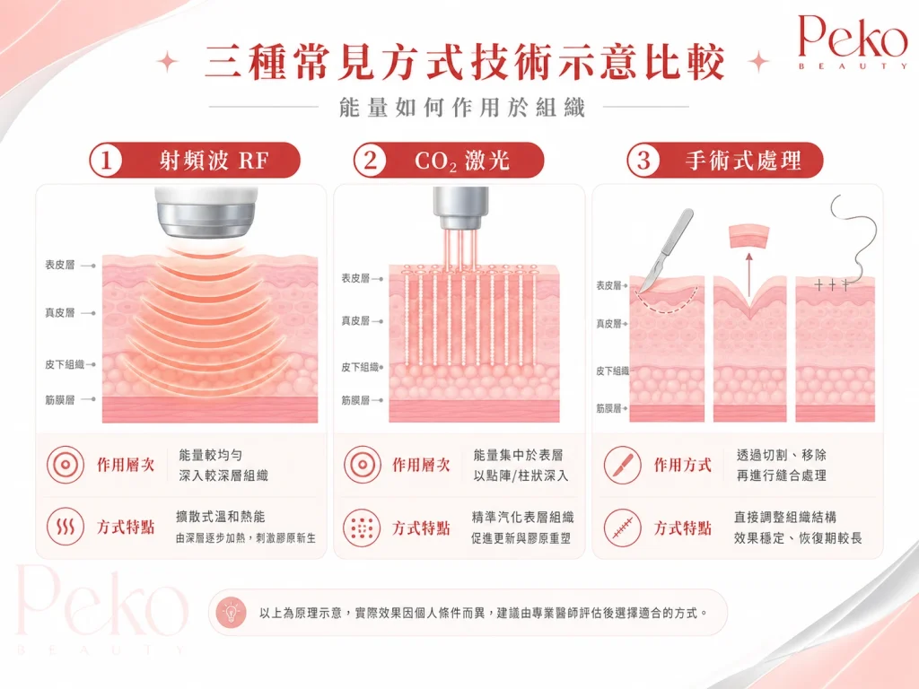 Peko Beauty BTL EMfemme 360收陰機 vs FemiLift CO2激光比較 香港