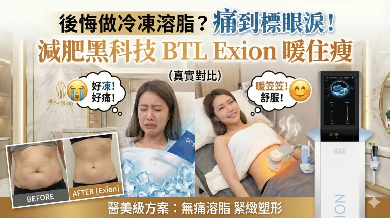 冷凍溶脂後悔痛到標眼淚？減肥黑科技Exion「暖住瘦」AI熱能溶脂，附真實痛感對比同躺平減肚原理拆解