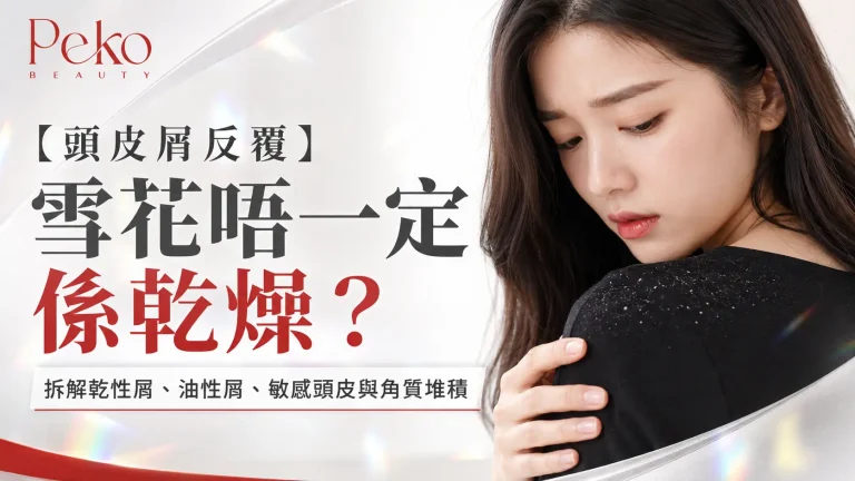 頭皮屑反覆出現唔係乾燥咁簡單：99%人都搞錯嘅原因，頭油、角質堆積同洗護習慣先係關鍵，頭皮檢測分清類型先至處理到