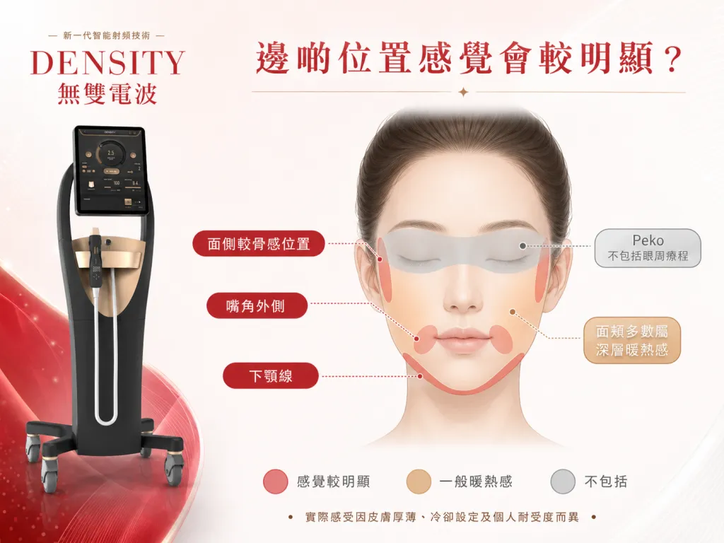 DENSITY 無雙電波面部不同位置痛感示意