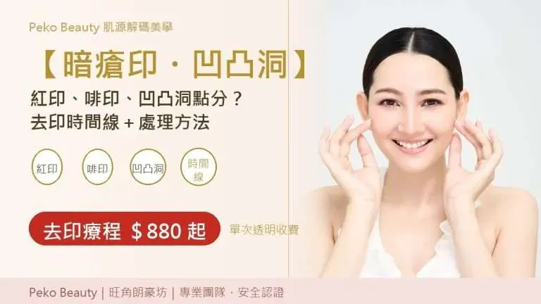 暗瘡印幾個月都唔退？紅印啡印凹凸洞成因、消退時間同去印療程價錢
