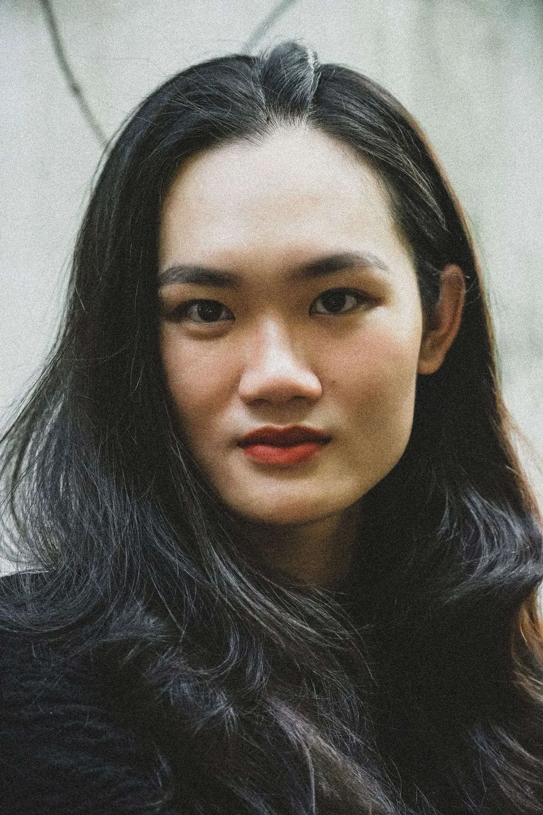 香港女生面部痘印色素分佈示意,紅色痘印同啡黑色痘印對比